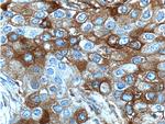 FUT4 Antibody in Immunohistochemistry (Paraffin) (IHC (P))