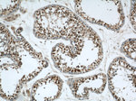 RCC1 Antibody in Immunohistochemistry (Paraffin) (IHC (P))