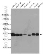 RCC1 Antibody in Western Blot (WB)