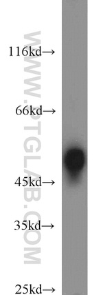 RCC1 Antibody in Western Blot (WB)