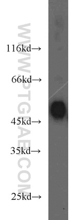 RCC1 Antibody in Western Blot (WB)