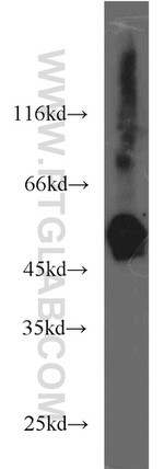 RCC1 Antibody in Western Blot (WB)