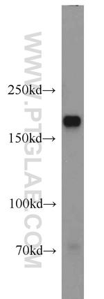 Integrin alpha-1 Antibody in Western Blot (WB)