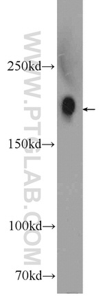 Integrin alpha-1 Antibody in Western Blot (WB)