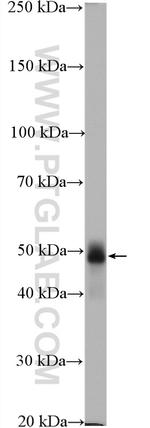 TRIM72 Antibody in Western Blot (WB)