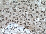 YY1 Antibody in Immunohistochemistry (Paraffin) (IHC (P))