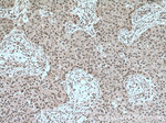 YY1 Antibody in Immunohistochemistry (Paraffin) (IHC (P))