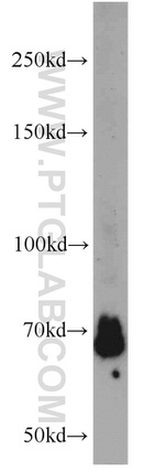 YY1 Antibody in Western Blot (WB)