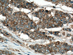 IQGAP1 Antibody in Immunohistochemistry (Paraffin) (IHC (P))