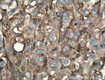 IQGAP1 Antibody in Immunohistochemistry (Paraffin) (IHC (P))