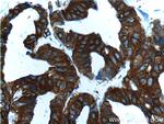 IQGAP1 Antibody in Immunohistochemistry (Paraffin) (IHC (P))