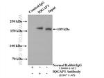 IQGAP1 Antibody in Immunoprecipitation (IP)