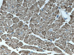 CPT1B Antibody in Immunohistochemistry (Paraffin) (IHC (P))