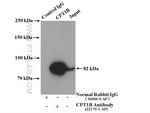 CPT1B Antibody in Immunoprecipitation (IP)