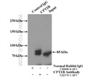 CPT1B Antibody in Immunoprecipitation (IP)