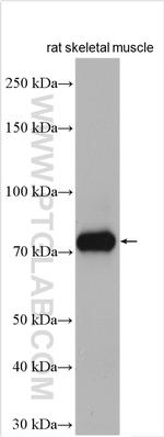 CPT1B Antibody in Western Blot (WB)