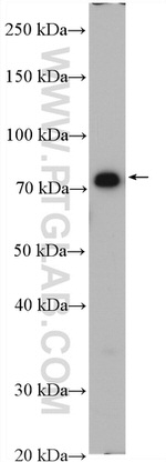 CPT1B Antibody in Western Blot (WB)