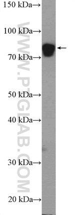 CPT1B Antibody in Western Blot (WB)