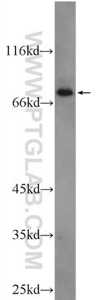 CPT1B Antibody in Western Blot (WB)