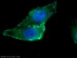 ARHGAP21 Antibody in Immunocytochemistry (ICC/IF)