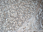 ARHGAP21 Antibody in Immunohistochemistry (Paraffin) (IHC (P))