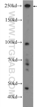 ARHGAP21 Antibody in Western Blot (WB)