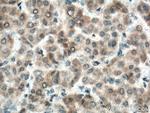 BMP3 Antibody in Immunohistochemistry (Paraffin) (IHC (P))