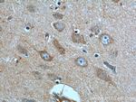 HTR1B Antibody in Immunohistochemistry (Paraffin) (IHC (P))