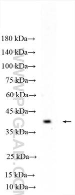 HTR1B Antibody in Western Blot (WB)