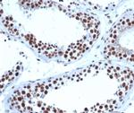 JAZF1 (Transcription Corepressor) Antibody in Immunohistochemistry (Paraffin) (IHC (P))