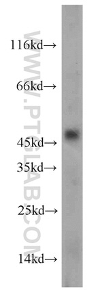 CHRNB4 Antibody in Western Blot (WB)