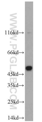 CHRNB4 Antibody in Western Blot (WB)