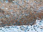 EXPH5 Antibody in Immunohistochemistry (Paraffin) (IHC (P))