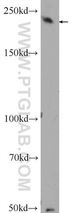 EXPH5 Antibody in Western Blot (WB)