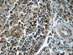 SYK Antibody in Immunohistochemistry (Paraffin) (IHC (P))