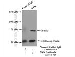 SYK Antibody in Immunoprecipitation (IP)