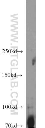 SYK Antibody in Western Blot (WB)