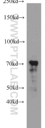 ZAP70 Antibody in Western Blot (WB)