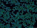 ZAP70 Antibody in Immunocytochemistry (ICC/IF)