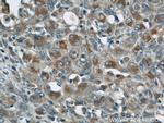 ZAP70 Antibody in Immunohistochemistry (Paraffin) (IHC (P))