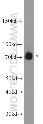 ZAP70 Antibody in Western Blot (WB)