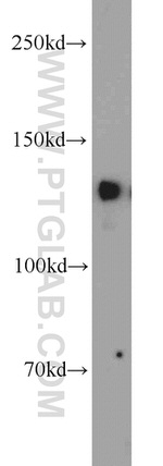 ERC1 Antibody in Western Blot (WB)