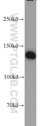 ERC1 Antibody in Western Blot (WB)