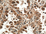 ACP1 Antibody in Immunohistochemistry (Paraffin) (IHC (P))