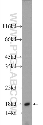 ACP1 Antibody in Western Blot (WB)