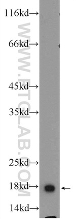 ACP1 Antibody in Western Blot (WB)