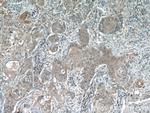 ACP1 Antibody in Immunohistochemistry (Paraffin) (IHC (P))