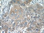 ACP1 Antibody in Immunohistochemistry (Paraffin) (IHC (P))