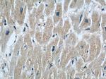 Rabenosyn 5 Antibody in Immunohistochemistry (Paraffin) (IHC (P))