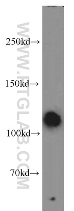 Rabenosyn 5 Antibody in Western Blot (WB)